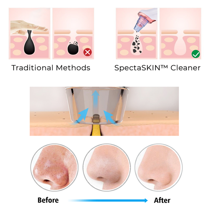Vacuum Pore Cleaner Pro