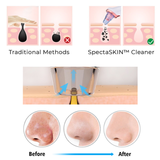 Vacuum Pore Cleaner Pro