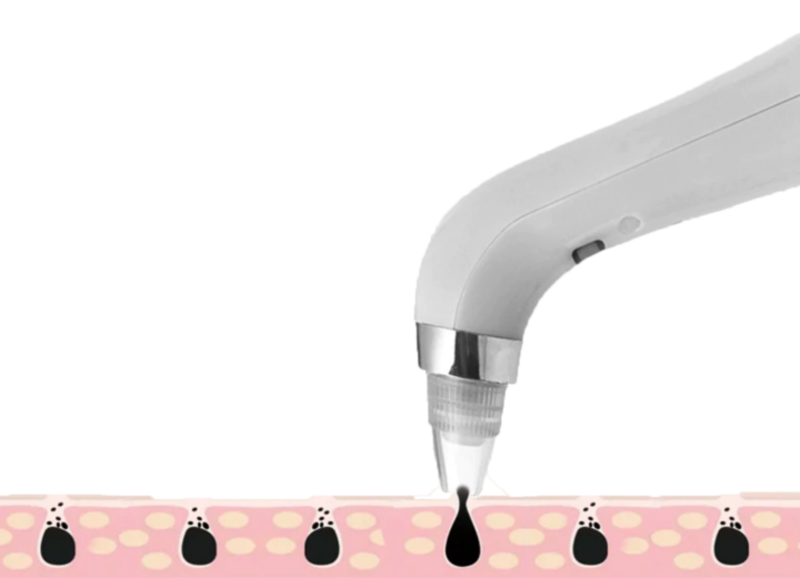 Vacuum Pore Cleaner Pro